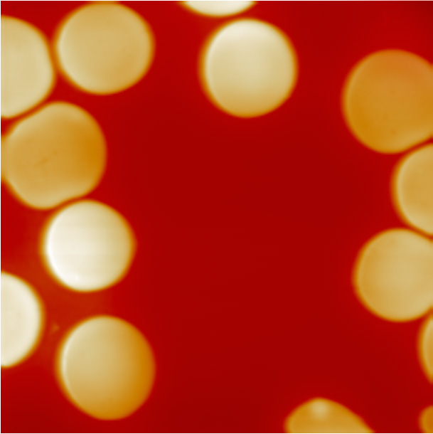 Red Blood Cells in Distilled Water